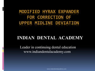 MODIFIED HYRAX EXPANDER
FOR CORRECTION OF
UPPER MIDLINE DEVIATION

INDIAN DENTAL ACADEMY
Leader in continuing dental education
www.indiandentalacademy.com

www.indiandentalacademy.com

 