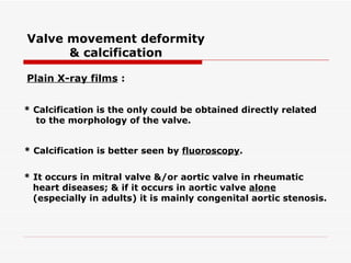 Valve movement deformity & calcification Plain X-ray films  :   * Calcification is the only could be obtained directly related to the morphology of the valve.   * Calcification is better seen by  fluoroscopy .   * It occurs in mitral valve &/or aortic valve in rheumatic heart diseases; & if it occurs in aortic valve   alone (especially in adults) it is mainly congenital aortic stenosis. 