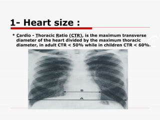 1- Heart size :  *  C ardio -  T horacic  R atio ( CTR ), is the maximum transverse diameter of the heart divided by the maximum thoracic diameter, in adult CTR < 50% while in children CTR < 60%. 