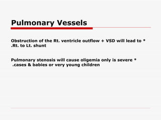 * Obstruction of the Rt. ventricle outflow + VSD will lead to Rt. to Lt. shunt. * Pulmonary stenosis will cause oligemia only is severe cases & babies or very young children.   Pulmonary Vessels 