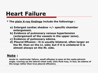 Heart Failure   * The  plain X-ray findings  include the followings : a) Enlarged cardiac shadow +/- specific chamber enlargement. b) Evidence of pulmonary venous hypertension (enlargement of the vessels in the upper   zone). c) Evidence of pulmonary edema. d) Pleural Effusion : It is usually bilateral, often larger on the Rt. than on the Lt. side; but if it is unilateral it is almost always on the Rt. side.   Note  :   Acute Lt. ventricular failure, small effusion is seen at the costo-phrenic angle, running up the lateral chest wall; (this fluid may, in fact, be edema of the lungs rather than true pleural effusion). 