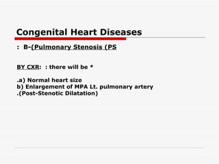 Congenital Heart Diseases
: B-(Pulmonary Stenosis (PS


BY CXR: : there will be *

.a( Normal heart size
b( Enlargement of MPA Lt. pulmonary artery
.(Post-Stenotic Dilatation(
 