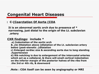 Congenital Heart Diseases
: C-(Coarctation Of Aorta (COA

 It is an abnormal aortic arch due to presence of *
 narrowing, just distal to the origin of the Lt. subclavian
  .artery

CXR findings: include *
  .a( Indentation of the aortic arch
  & ,(b( Dilatation above (dilatation of the Lt. subclavian artery
  below (post-stenotic .(dilatation
  c( Enlarged cardiac size & ascending aorta due to long standing
  .hypertension
  d( Rib notching is due to enlargement of the intercostal arteries
  which act as a collateral, & there will small cortical indentation
  on the inferior margin of the posterior halves of the ribs from
  .the 3rd or 4th rib, & downward

  .Note : COA itself can be seen by angiography or MRI
 