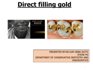 Direct filling gold
PRESENTED BY:DR.AJAY BABU GUTTI
IIYEAR PG
DEPARTMENT OF CONSERVATIVE DENTISTRY AND
ENDODONTICS
1
 