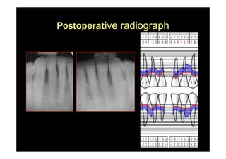 Postoperative radiograph
 