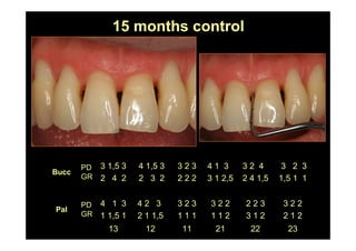 15 months control
232221111213
3 2 2
2 1 2
2 2 3
3 1 2
3 2 2
1 1 2
3 2 3
1 1 1
4 2 3
2 1 1,5
4 1 3
1 1,5 1
PD
GR
Pal
3 2 3
1,5 1 1
3 2 4
2 4 1,5
4 1 3
3 1 2,5
3 2 3
2 2 2
4 1,5 3
2 3 2
3 1,5 3
2 4 2
PD
GR
Bucc
 