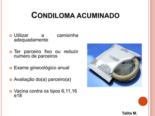 CONDILOMA ACUMINADO
 Utilizar a camisinha
adequadamente
 Ter parceiro fixo ou reduzir
numero de parceiros
 Exame ginecológico anual
 Avaliação do(a) parceiro(a)
 Vacina contra os tipos 6,11,16
e18
Talita M.
 