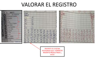 VALORAR EL REGISTRO
PACIENTE SE LE RETIRA
ACCESORIOS QUE ↑ ESPACIO
MUERTO RESULTADO ↓
EtCO2
 