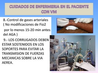 8.-Control de gases arteriales
( No modificaciones de Fio2
por lo menos 15-20 min antes
del AGA )
9.- LOS CORRUGADOS DEBEN
ESTAR SOSTENIDOS EN LOS
SOPORTES PARA EVITAR LA
TRANSMISION DE FUERZAS
MECANICAS SOBRE LA VIA
AEREA.
 