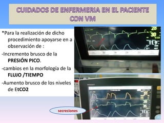 *Para la realización de dicho
procedimiento apoyarse en a
observación de :
-Incremento brusco de la
PRESIÓN PICO.
-cambios en la morfología de la
FLUJO /TIEMPO
-Aumento brusco de los niveles
de EtCO2
secreciones
 
