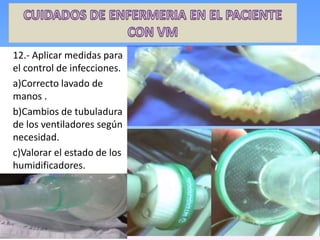 12.- Aplicar medidas para
el control de infecciones.
a)Correcto lavado de
manos .
b)Cambios de tubuladura
de los ventiladores según
necesidad.
c)Valorar el estado de los
humidificadores.
 