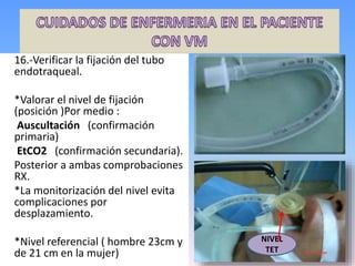 16.-Verificar la fijación del tubo
endotraqueal.
*Valorar el nivel de fijación
(posición )Por medio :
Auscultación (confirmación
primaria)
EtCO2 (confirmación secundaria).
Posterior a ambas comprobaciones
RX.
*La monitorización del nivel evita
complicaciones por
desplazamiento.
*Nivel referencial ( hombre 23cm y
de 21 cm en la mujer)
NIVEL
TET
 