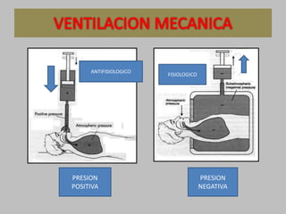PRESION
POSITIVA
PRESION
NEGATIVA
FISIOLOGICO
ANTIFISIOLOGICO
 