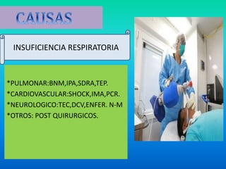*PULMONAR:BNM,IPA,SDRA,TEP.
*CARDIOVASCULAR:SHOCK,IMA,PCR.
*NEUROLOGICO:TEC,DCV,ENFER. N-M
*OTROS: POST QUIRURGICOS.
INSUFICIENCIA RESPIRATORIA
 