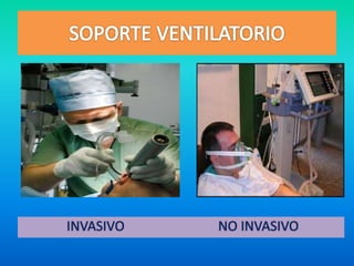 INVASIVO NO INVASIVO
 