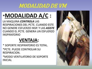 MODALIDAD DE VM
*MODALIDAD A/C :
LA MAQUINA CONTROLA LAS
RESPIRACIONES DEL PCTE. CUANDO ESTE
NO GENERE ESFUERZO INSP. Y LAS ASISTE
CUANDO EL PCTE. GENERA UN ESFUERZO
INSPIRATORIO
VENTAJA:
* SOPORTE RESPIRATORIO ES TOTAL.
*PCTE. PUEDE CONTROLAR SU
RESPIRACION.
*MODO VENTILATORIO DE SOPORTE
INICIAL
 