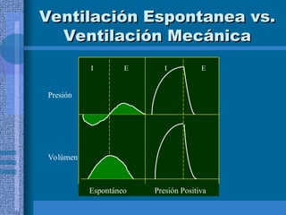 Ventilación Espontanea vs.
Ventilación Espontanea vs.
Ventilación Mecánica
Ventilación Mecánica
I E I E
Presión
Volúmen
Espontáneo Presión Positiva
I E I E
 