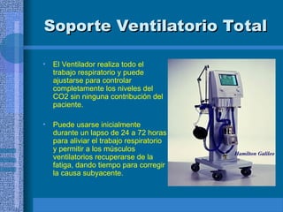 Soporte Ventilatorio Total
Soporte Ventilatorio Total
• El Ventilador realiza todo el
trabajo respiratorio y puede
ajustarse para controlar
completamente los niveles del
CO2 sin ninguna contribución del
paciente.
• Puede usarse inicialmente
durante un lapso de 24 a 72 horas
para aliviar el trabajo respiratorio
y permitir a los músculos
ventilatorios recuperarse de la
fatiga, dando tiempo para corregir
la causa subyacente.
Hamilton Galileo
 