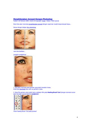 Menghilangkan Jerawat Dengan Photoshop
Publish: 08 Februari 2008 | Author & Copyright: Irvan | Status: FREE tutorial

Disini kita akan mencoba menghilangkan jerawat dengan cepat dan mudah tanpa banyak biaya...

Hanya dengan belajar ilmu photoshop




mari kita buktikan...

Langkah-Langkahnya:




1. Kita akan mencoba pada gambar yang telah tersedia di atas.
Anda bisa download atau save as gambar di atas.

2. Buka file gambar yang sudah kamu sediakan Klik pada Healing Brush Tool (dengan otomatis kursor
akan berubah menjadi bentuk Lingkaran)




Posisi Healing Brush Tool pada jerawat



                                                                                                    4
 