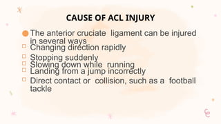 Comprehensive Guide to Anterior Cruciate Ligament Injury and ...