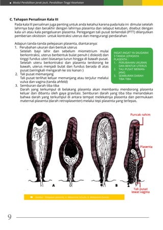 Modul Pendidikan Jarak Jauh, Pendidikan Tinggi Kesehatan
9
C. Tahapan Persalinan Kala III
Pada kala III persalinan juga penting untuk anda ketahui karena pada kala ini dimulai setelah
lahirnya bayi dan berakhir dengan lahirnya plasenta dan selaput ketuban, disebut dengan
kala uri atau kala pengeluaran plasenta. Peregangan tali pusat terkendali (PTT) dilanjutkan
pemberian oksitosin untuk kontraksi uterus dan mengurangi perdarahan
Adapun tanda-tanda pelepasan plasenta, diantaranya:
1.	 Perubahan ukuran dan bentuk uterus
	 Setelah bayi lahir dan sebelum miometrium mulai
berkontraksi, uterus berbentuk bulat penuh ( diskoid) dan
tinggi fundus uteri biasanya turun hingga di bawah pusat.
Setelah uteru berkontraksi dan plasenta terdorong ke
bawah, uterus menjadi bulat dan fundus berada di atas
pusat (seringkali mengarah ke sisi kanan )
2.	 Tali pusat memanjang
	 Tali pusat terlihat keluar memanjang atau terjulur melalui
vulva dan vagina (tanda ahfeld)
3.	 Semburan darah tiba tiba
	 Darah yang terkumpul di belakang plasenta akan membantu mendorong plasenta
keluar dan dibantu oleh gaya gravitasi. Semburan darah yang tiba tiba menandakan
bahwa darah yang terkumpul di antara tempat melekatnya plasenta dan permukaan
maternal plasenta (darah retroplasenter) melalui tepi plasenta yang terlepas.
INGAT-INGAT YA SAUDARA!
3 TANDA LEPASNYA
PLASENTA :
1.	 PERUBAHAN UKURAN
DAN BENTUK UTERUS
2.	 TALI PUSAT MEMAN-
JANG
3.	 SEMBURAN DARAH
TIBA TIBA
Gambar : Pelepasan pkasenta, A. Mekanisme Schulze; B. Mekanisme Duncan
 