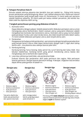 Modul Pendidikan Jarak Jauh, Pendidikan Tinggi Kesehatan
10D. Tahapan Persalinan Kala IV
Dimulai setelah lahirnya plasenta dan berakhir dua jam setelah itu , Paling kritis karena
proses perdarahan yang berlangsung, Masa 1 jam setelah plasenta lahir, Observasi intensif
karena peradrahan yang terjadi pada masa ini, Pemantauan 15 menit pada jam pertama
setelah kelahiran plasenta, 30 menit pada jam kedua setelah persalinan, jika kondisi ibu
tidak stabil ibu dipantau lebih sering.
7 langkah pemeriksaan penting yang dilakukan di kala IV:
1.	 Kontraksi rahim
	 Dapat diketahui dengan palpasi. Setelah plasenta lahir dilakukan pemijatan uterus untuk
merangsang uterus berkontraksi. Dalam evaluasi uterus yang perlu dilakukan adalah
mengobservasi kontraksi dan konsistensi uterus. Kontraksi uterus yang normal adalah
pada perabaan fundus uteri akan teraba keras. Jika tidak terjadi kontraksi dalam waktu
15 menit setelah dilakukan pemijatan uterus akan terjadi atonia uteri.
2.	Perdarahan
	 Pengawasanterhadapjumlahperdarahan,warnakarenadenganterjadinyaperadarahan
yang banyak berarti uterus tidak dapat berkontraksi dengan baik-- ingat akan bahay
atonia uteri , sisa plasenta atau adanya laserasi jalan lahir.
3.	 Kandung kencing
	 Kandung kencing: harus kosong, kalau penuh ibu suruh kencing dan kalau tidak bisa
lakukan kateterisasi. Kandung kemih yang penuh mendorong uterus keatas dan
menghalangi uterus berkontraksi sepenuhnya.
4.	 Luka-luka: jahitannya baik/tidak, ada perdarahan/tidak
	 Evaluasi laserasi dan perdarahan aktif pada perineum dan vagina. Nilai perluasan
laserasi perineum. Derajat laserasi perineum terbagi 4 derajad . tingkatan luka tersebut
dapat dilihat pada gambar di bawah ini :
Gambar : Robekan perineum
Derajat satu
•	 Mukosa vagina
•	 Komisura posterior
•	 Kulit perineum
•	 Otot perineum
Tak perlu dijahit jika
tidak ada perdarahan
dan aposisi luka baik
Derajat dua
•	 Mukosa vagina
•	 Komisura posterior
•	 Kulit perineum
•	 Otot perineum
Jahit menggunakan
teknik yang digunakan
pada lampiran 4
Derajat tiga
•	 Mukosa vagina
•	 Komisura posterior
•	 Kulit perineum
•	 Otot perineum
•	 Otot sfingter ani
Derajat empat
•	 Mukosa vagina
•	 Komisura posterior
•	 Kulit perineum
•	 Otot sfingter ani
•	 Dinding depan rektum
Penolong APN tidak dibekali keterampilan untuk
reparasi laserasi perineum derajat tiga atau empat.
Segera rujuk ke fasilitas rujukan
 