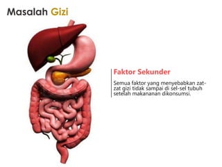 Faktor Sekunder
Semua faktor yang menyebabkan zat-
zat gizi tidak sampai di sel-sel tubuh
setelah makananan dikonsumsi.
Masalah Gizi
 