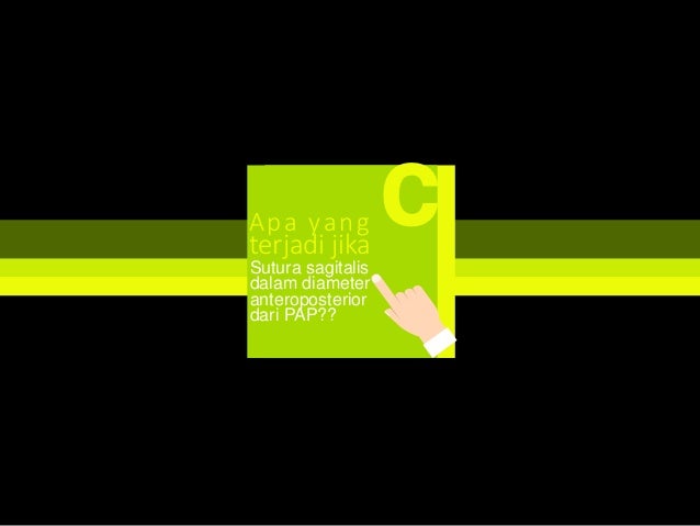 Modul 1 kb 2 tahapan persalinan