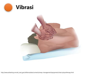 Vibrasi
http://www.atitesting.com/ati_next_gen/skillsmodules/content/airway-management/equipment/chest-physiotherapy.html
 