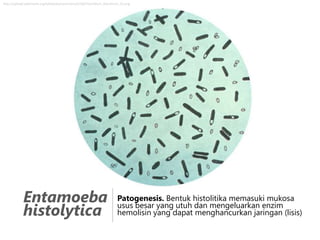 http://upload.wikimedia.org/wikipedia/commons/5/58/Clostridium_botulinum_01.png

Entamoeba
histolytica

Patogenesis. Bentuk histolitika memasuki mukosa
usus besar yang utuh dan mengeluarkan enzim
hemolisin yang dapat menghancurkan jaringan (lisis)

 