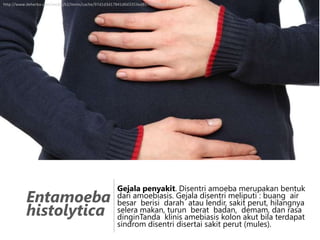 http://www.deherba.com/media/k2/items/cache/97d1d3d17841d6d3353ed857f6573ac4_XL.jpg

Entamoeba
histolytica

Gejala penyakit. Disentri amoeba merupakan bentuk
dari amoebiasis. Gejala disentri meliputi : buang air
besar berisi darah atau lendir, sakit perut, hilangnya
selera makan, turun berat badan, demam, dan rasa
dinginTanda klinis amebiasis kolon akut bila terdapat
sindrom disentri disertai sakit perut (mules).

 