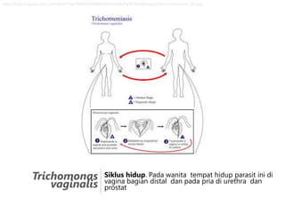 http://3.bp.blogspot.com/_m2edhcb7FYg/TKMBY6UOXQI/AAAAAAAAAFg/fE2QOdZSdrg/s320/Trichomoniasis_01.png

Trichomonas
vaginalis

Siklus hidup. Pada wanita tempat hidup parasit ini di
vagina bagian distal dan pada pria di urethra dan
prostat

 
