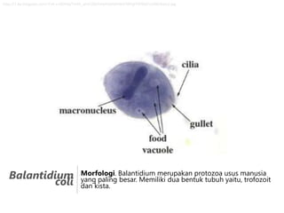 http://1.bp.blogspot.com/-FsA-s-JdO4Q/TmOt_ahGUQI/AAAAAAAAAB4/iWFgIT9FKk8/s1600/bala3.jpg

Balantidium
coli

Morfologi. Balantidium merupakan protozoa usus manusia
yang paling besar. Memiliki dua bentuk tubuh yaitu, trofozoit
dan kista.

 