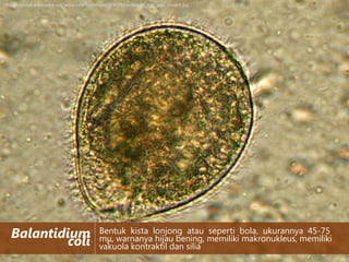 http://upload.wikimedia.org/wikipedia/commons/4/47/Balantidium_coli_wet_mount.jpg

Balantidium
coli

Bentuk kista lonjong atau seperti bola, ukurannya 45-75
mμ, warnanya hijau bening, memiliki makronukleus, memiliki
vakuola kontraktil dan silia

 