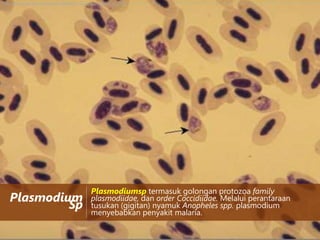 http://library.thinkquest.org/03oct/00946/pic_used/avian_plasmodium.jpg

Plasmodium
Sp

Plasmodiumsp termasuk golongan protozoa family
plasmodiidae, dan order Coccidiidae. Melalui perantaraan
tusukan (gigitan) nyamuk Anopheles spp. plasmodium
menyebabkan penyakit malaria.

 