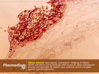 http://3.bp.blogspot.com/-dCcTbJtMJ3E/Tq0voENIqEI/AAAAAAAAAUk/O4fJ_wsWfws/s1600/aa9.JPG

Plasmodium
Sp

Siklus seksual (Sporogoni). Gametosit matang di dalam
darah penderita yang terhisap oleh nyamuk, akan mengalami
proses pematangan di dalam usus nyamuk untuk menjadi
gamet (gametogenesis).

 