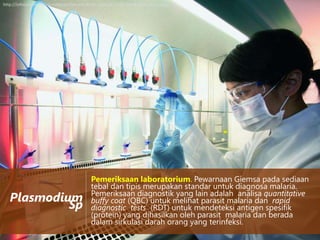 http://infolaboratoriumkesehatan.files.wordpress.com/2012/05/laboratory-safety.jpg

Plasmodium
Sp

Pemeriksaan laboratorium. Pewarnaan Giemsa pada sediaan
tebal dan tipis merupakan standar untuk diagnosa malaria.
Pemeriksaan diagnostik yang lain adalah analisa quantitative
buffy coat (QBC) untuk melihat parasit malaria dan rapid
diagnostic tests (RDT) untuk mendeteksi antigen spesifik
(protein) yang dihasilkan oleh parasit malaria dan berada
dalam sirkulasi darah orang yang terinfeksi.

 