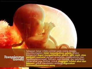 http://henryastor.com/wp-content/uploads/2011/04/baby-2.jpeg

Toxoplasma
Gondii

Sebagian besar infeksi primer pada orang dewasa
imunokompeten tidak menunjukkan gejala. Infeksi
kongenital dapat mengakibatkan aborsi, lahir mati, atau
penyakit neonatal dengan ensefalitis, chorioretinitis dan
hepatosplenomegali. Demam, sakit kuning, dan kalsifikasi
intrakranial juga terlihat. Untuk diagnosis infeksi akut dan
bawaan, untuk mendeteksi antibodi digunakan
immunofluorescence assay

 