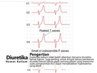 http://upload.wikimedia.org/wikipedia/commons/4/49/ECG_in_hyperkalemia.png

Diuretika

Pengertian

Suplemen kalium tidak boleh diberikan bersama diuretika
hemat kalium. Juga penting untuk diingat bahwa pemberian
H e m a t K a l i u m diuretka hemat kalium pada seorang pasien yang menerima
suatu penghambat ACE dapat menyebabkan hiperkalemia
yang berat.

 