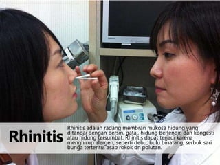 http://www.jasengusa.com/wp-content/uploads/jaseng_1.jpg

Rhinitis

Rhinitis adalah radang membran mukosa hidung yang
ditandai dengan bersin, gatal, hidung berlendir, dan kongesti
atau hidung tersumbat. Rhinitis dapat terjadi karena
menghirup alergen, seperti debu, bulu binatang, serbuk sari
bunga tertentu, asap rokok dn polutan.

 