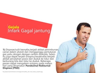 Infark Gagal jantung
http://www.heartmdinstitute.com/images/stories/Man_with_heart_attack_symptoms.jpg
Gejala
1) Dispnoe/sulit bernafas,terjadi akibat penimbunan
cairan dalam alveoli dan mengganggu pertukaran
gas yaitu oksigen dengan carbon dioksida. Selain
itu juga dapat terjadi ortopnu/sesaknafas berjadi
akibat perubahan posisi dari duduk ke tidur dan
berkurang bila dari tidur ke duduk. Beberapa
pasien dapat mengalami ortopnu pada malam
hari yang dinamakan Paroksimal Nokturnal
Dispnea (PND)
 