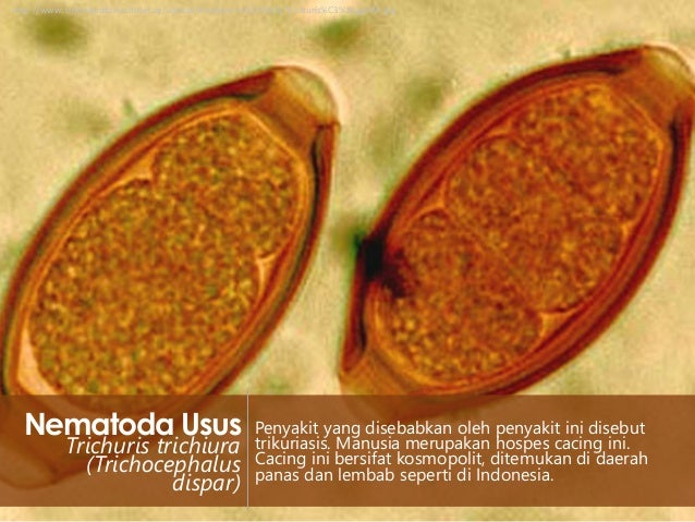 71 Gambar Telur Cacing Nematoda Usus Terlihat Keren 71 Gambar Telur Cacing Nematoda Usus Terlihat Keren