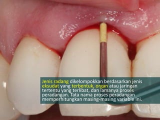 Jenis radang dikelompokkan berdasarkan jenis
eksudat yang terbentuk, organ atau jaringan
tertentu yang terlibat, dan lamanya proses
peradangan. Tata nama proses peradangan
memperhitungkan masing-masing variable ini.
 