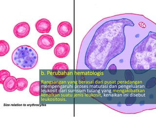 b. Perubahan hematologis
Rangsangan yang berasal dari pusat peradangan
mempengaruhi proses maturasi dan pengeluaran
leukosit dari sumsum tulang yang mengakibatkan
kenaikan suatu jenis leukosit, kenaikan ini disebut
leukositosis.
 