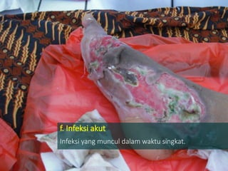 f. Infeksi akut
Infeksi yang muncul dalam waktu singkat.
 