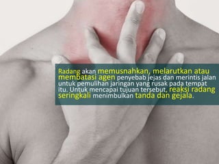 Radang akan memusnahkan, melarutkan atau
membatasi agen penyebab jejas dan merintis jalan
untuk pemulihan jaringan yang rusak pada tempat
itu. Untuk mencapai tujuan tersebut, reaksi radang
seringkali menimbulkan tanda dan gejala.
 