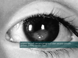 Infeksi terjadi secara progresif dan secara umum
proses infeksi terdiri dari:
 