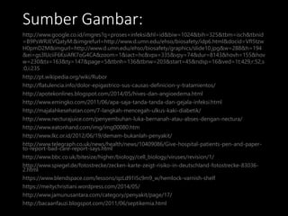 Sumber Gambar:
http://www.google.co.id/imgres?q=proses+infeksi&hl=id&biw=1024&bih=325&tbm=isch&tbnid
=B9PsWRJEVQatyM:&imgrefurl=http://www.d.umn.edu/ehso/biosafety/idp6.html&docid=VfI5tzw
H0pmD2M&imgurl=http://www.d.umn.edu/ehso/biosafety/graphics/slide10.jpg&w=288&h=194
&ei=gs3lUciiF6KsiAfK7oG4CA&zoom=1&iact=hc&vpx=335&vpy=74&dur=8143&hovh=155&hov
w=230&tx=163&ty=147&page=5&tbnh=136&tbnw=203&start=45&ndsp=16&ved=1t:429,r:52,s
:0,i:235
http://pt.wikipedia.org/wiki/Rubor
http://flatulencia.info/dolor-epigastrico-sus-causas-definicion-y-tratamientos/
http://apotekonlines.blogspot.com/2014/05/hives-dan-angioedema.html
http://www.emingko.com/2011/06/apa-saja-tanda-tanda-dan-gejala-infeksi.html
http://majalahkesehatan.com/7-langkah-mencegah-ulkus-kaki-diabetik/
http://www.necturajuice.com/penyembuhan-luka-bernanah-atau-abses-dengan-nectura/
http://www.eatonhand.com/img/img00080.htm
http://www.lkc.or.id/2012/06/19/demam-bukanlah-penyakit/
http://www.telegraph.co.uk/news/health/news/10409086/Give-hospital-patients-pen-and-paper-
to-report-bad-care-report-says.html
http://www.bbc.co.uk/bitesize/higher/biology/cell_biology/viruses/revision/1/
http://www.spiegel.de/fotostrecke/zecken-karte-zeigt-risiko-in-deutschland-fotostrecke-83036-
2.html
https://www.blendspace.com/lessons/qzLd91I5c9m9_w/hemlock-varnish-shelf
https://meitychristiani.wordpress.com/2014/05/
http://www.jamunusantara.com/category/penyakit/page/17/
http://bacaanfauzi.blogspot.com/2011/06/septikemia.html
 