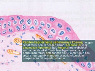 Kapiler-kapiler yang sebelumnya kosong dengan
cepat terisi penuh dengan darah. Keadaan ini yang
dinamakan hiperemia atau kongesti,menyebabkan
warna merah lokal. Timbulnya hyperemia pada
permulaan reaksi peradangan diatur oleh tubuh baik
secara neurogenik maupun secara kimia,melalui
pengeluaran zat seperti histamin.
 