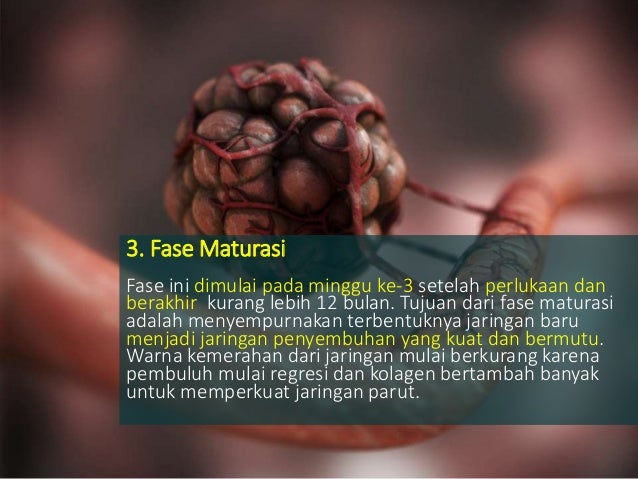 Faktorfaktor Yang Mempengaruhi Lama Penyembuhan Luka Pada Faktorfaktor Yang Mempengaruhi Lama Penyembuhan Luka Pada